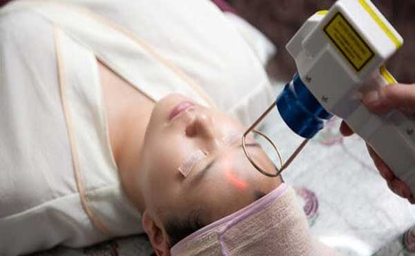 Lợi ích xóa nám bằng laser